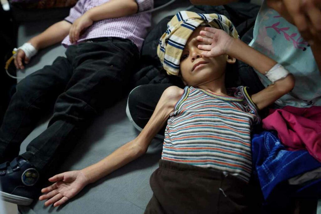 El gobierno del movimiento islamista palestino Hamás, afirma que al menos 32 personas, murieron por desnutrición en Gaza. Foto: AFP