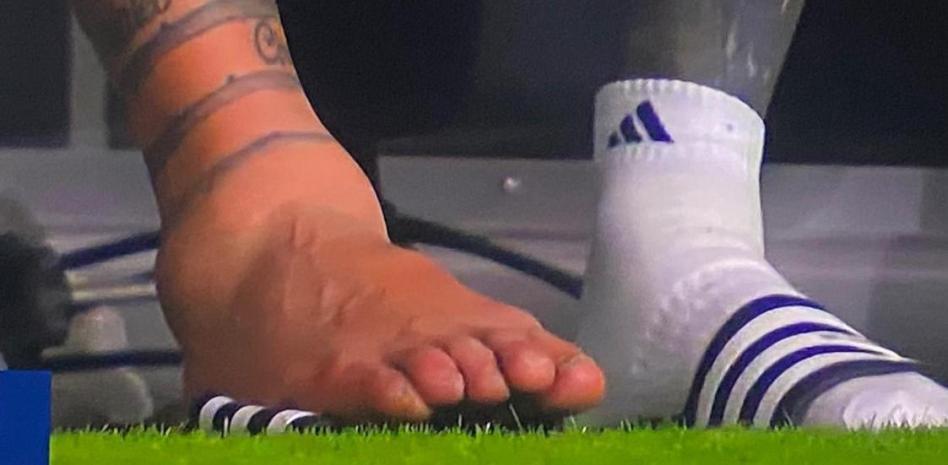 Así quedó el tobillo de Lionel Messi luego de la lesión que lo obligó a salir en la final