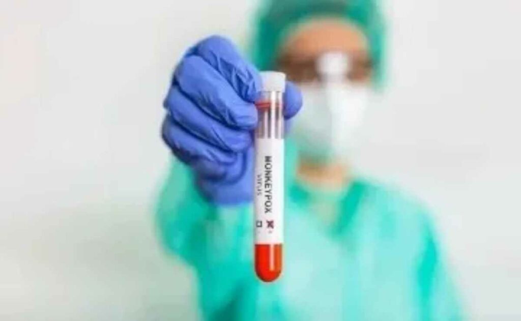 Marruecos registró un caso de la nueva variante de mpox en la ciudad turística de Marrakech, el primero en el norte de África.