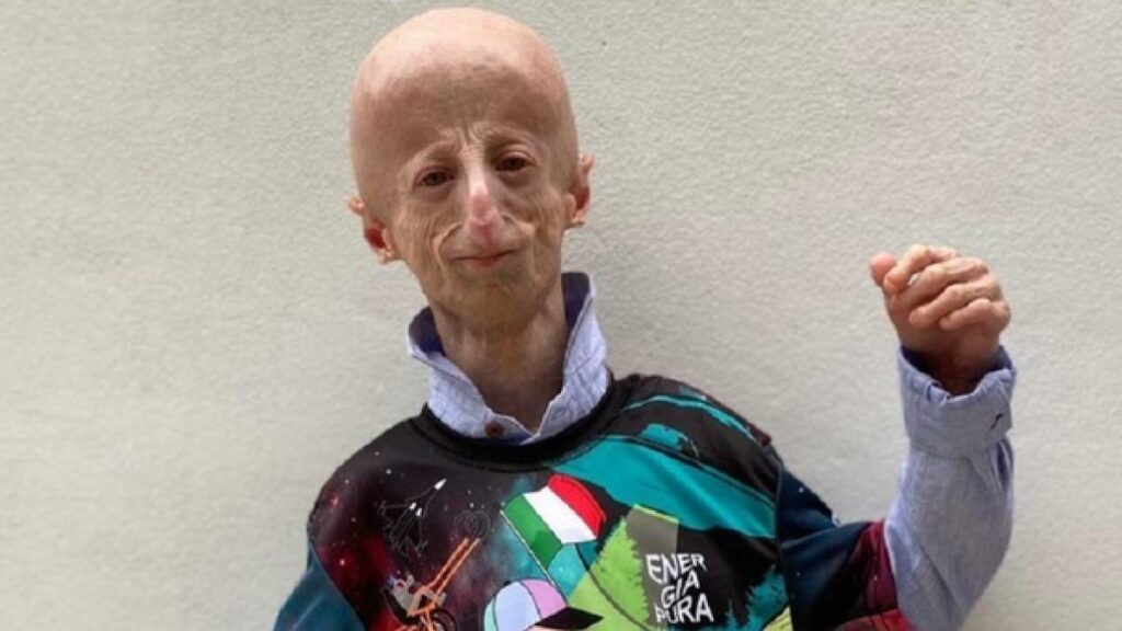 Muere el hombre màs longevo a los 28 años