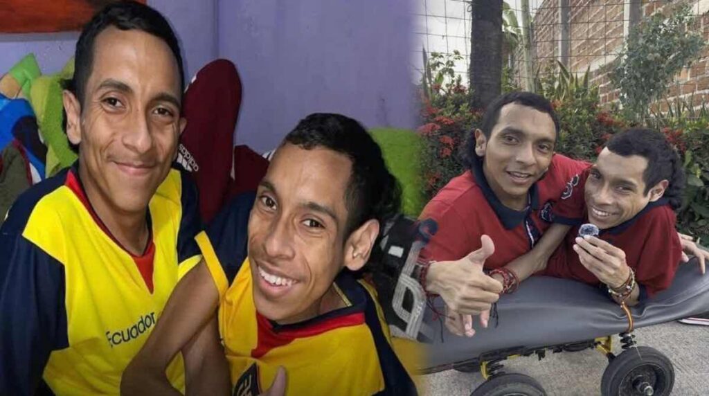 Fallecen los famosos hermanos siameses de Ecuador